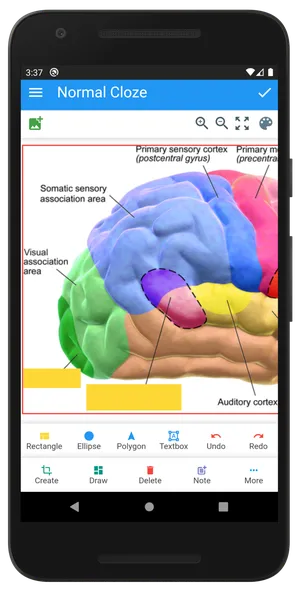 Anki Image Occlusion